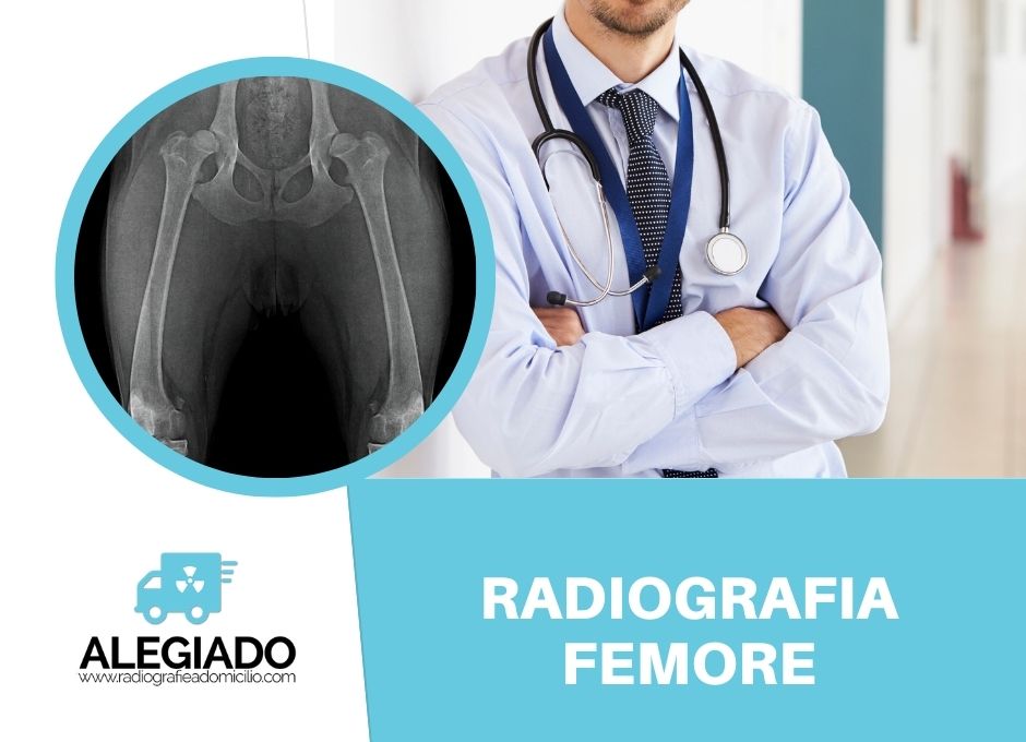 Radiografia Femore