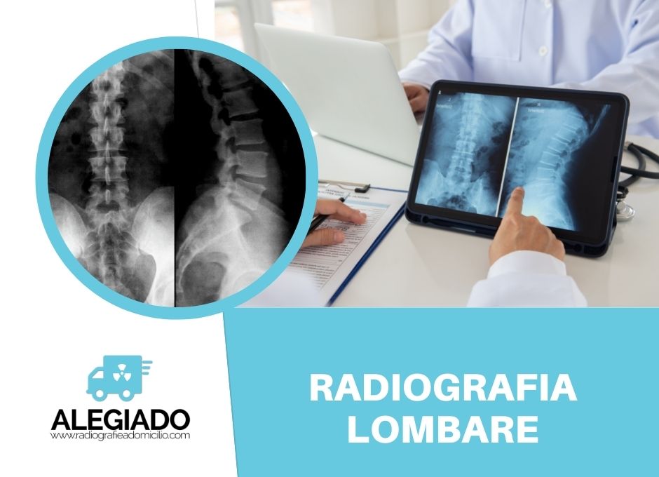 Radiografia Lombare